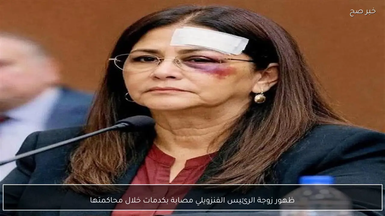 ظهور زوجة الرئيس الفنزويلي مصابة بكدمات خلال محاكمتها